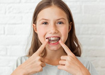 Teen girl pointing to clear aligners