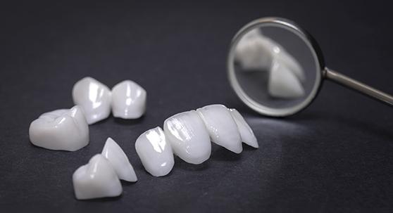 All-ceramic dental bridges