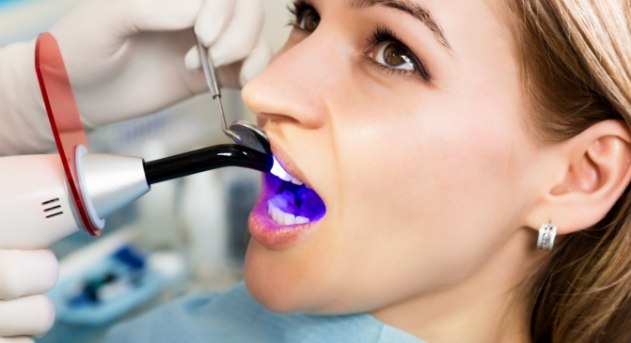 Dentistry patient receiving cosmetic dental bonding